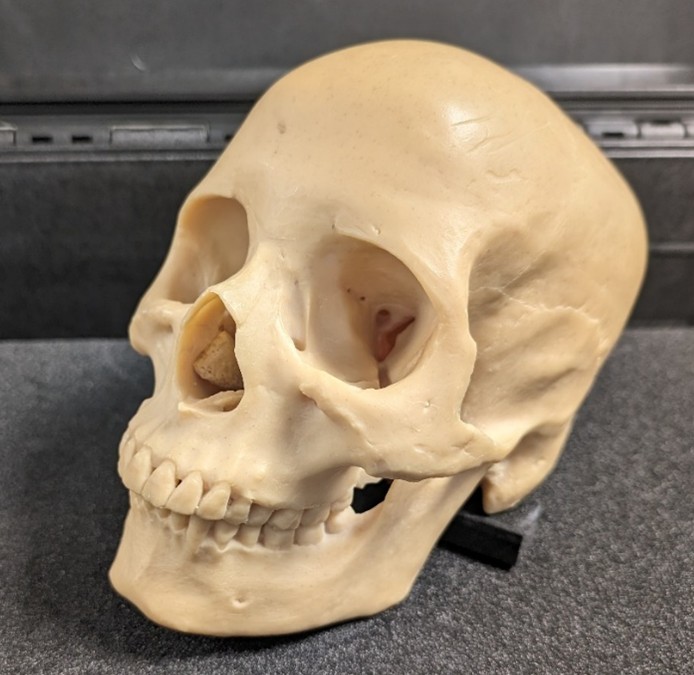 Homo sapiens Human Skull